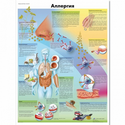 Плакат Аллергия