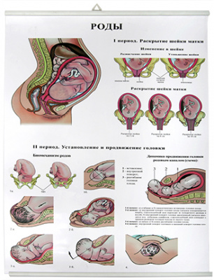 Плакат Роды (85х60 см)